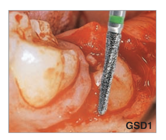 GSD1.314.016